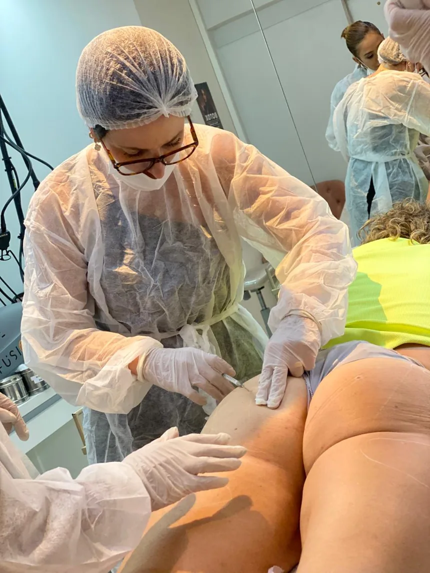 Profissional de touca e avental aplicando em paciente modelo, com a região já marcada