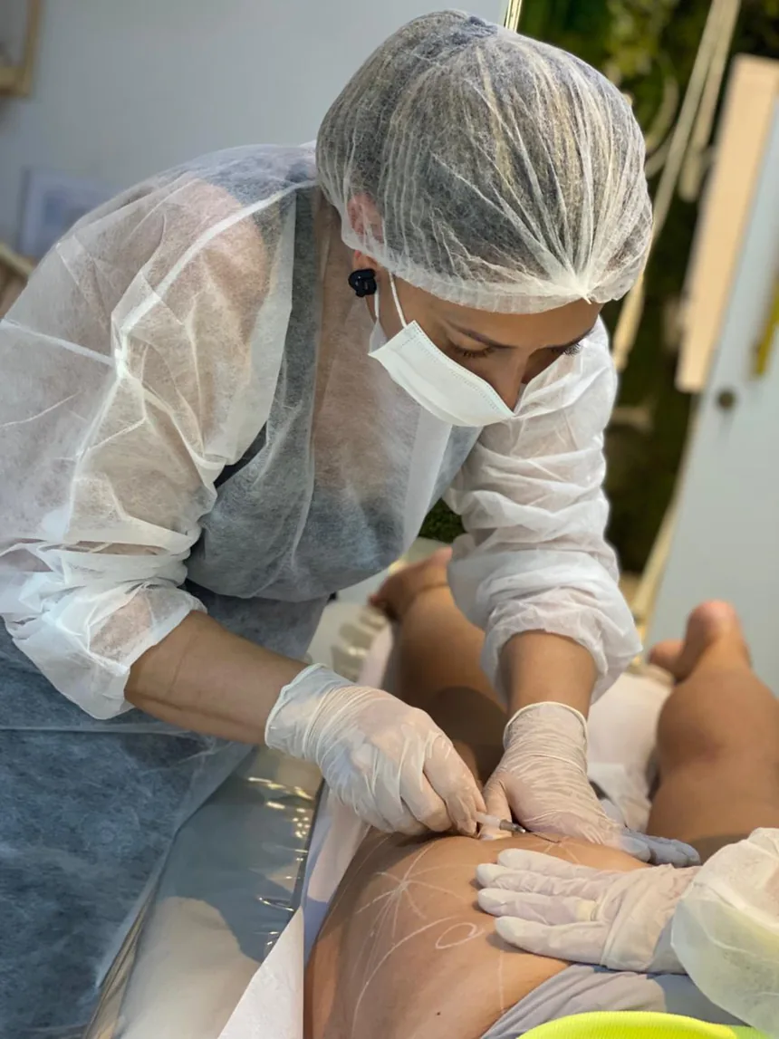 Aplicação em paciente modelo vista de perto, com as mãos enluvadas conduzindo a cânula